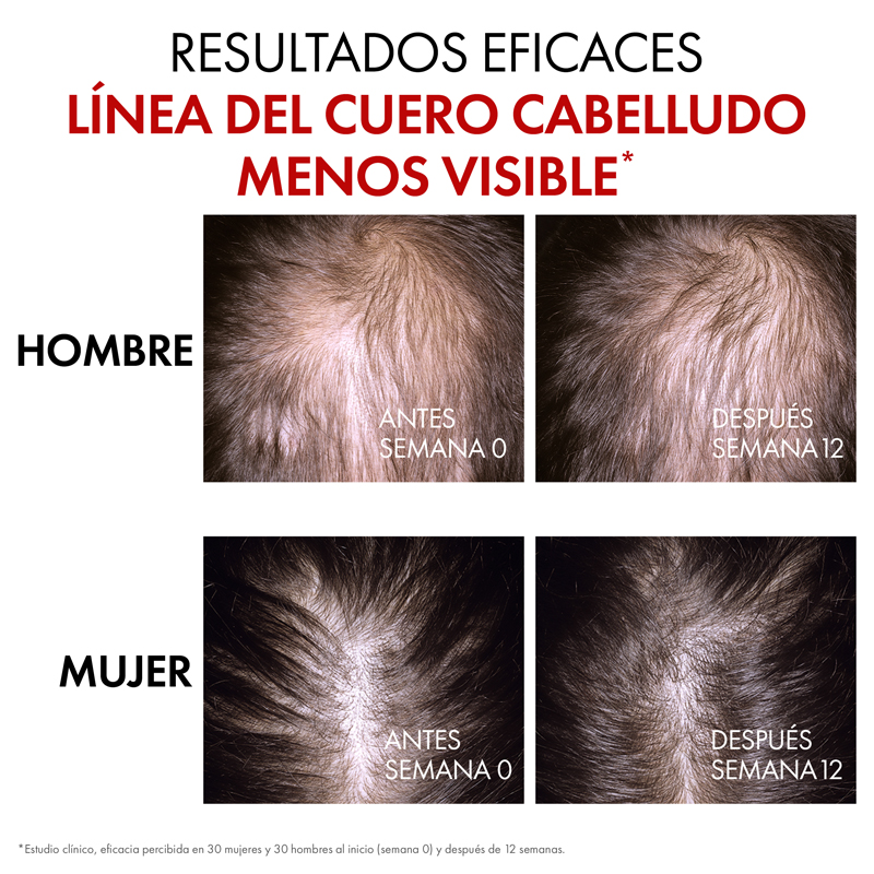 Vichy Dercos Aminexil Regen Booster 90 Ml - Imagen 3